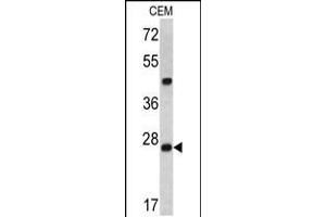 Western blot analysis of Dcr-1 antibody in CEM cell line lysates (35ug/lane)