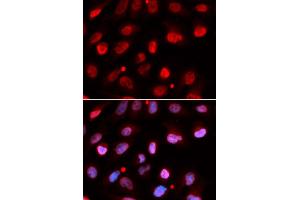 Immunofluorescence (IF) image for anti-Ring Finger Protein 2 (RNF2) antibody (ABIN1876743) (RNF2 Antikörper)