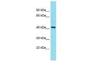 Western Blotting (WB) image for anti-Family with Sequence Similarity 181, Member B (FAM181B) (N-Term) antibody (ABIN2791533) (FAM181B Antikörper  (N-Term))