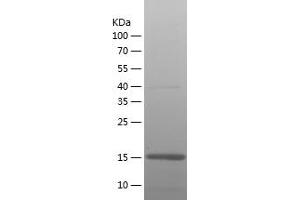Western Blotting (WB) image for Glial Fibrillary Acidic Protein (GFAP) (AA 292-432) protein (His tag) (ABIN7123094) (GFAP Protein (AA 292-432) (His tag))