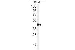 Image no. 1 for anti-Gap Junction Protein, alpha 1, 43kDa (GJA1) (N-Term) antibody (ABIN357085) (Connexin 43/GJA1 Antikörper  (N-Term))