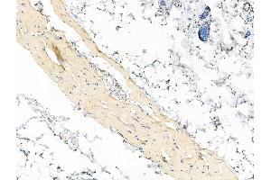 Phospho-CXCR4 (Ser339) Antibody at 1/100 staining Rat skin tissue by IHC-P.