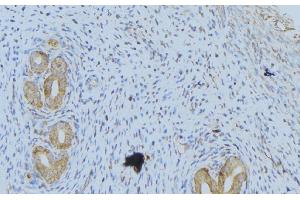 Immunohistochemistry (IHC) image for anti-Wingless-Type MMTV Integration Site Family, Member 1 (WNT1) (C-Term) antibody (ABIN6266035)