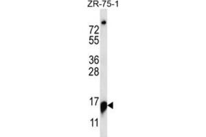 Western Blotting (WB) image for anti-Ribonuclease P/MRP 25kDa Subunit (RPP25) antibody (ABIN2997146) (RPP25 Antikörper)