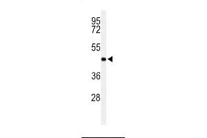 Western blot analysis of RPR1B Antibody in Jurkat cell line lysates (35ug/lane) (RPRD1B Antikörper  (C-Term))