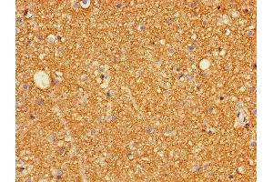 Immunohistochemistry of paraffin-embedded human brain tissue using ABIN7153961 at dilution of 1:100 (Glutamate Receptor 3 Antikörper  (AA 151-250))