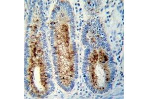 Anti-Myeloperoxidase antibody immunohistochemistry analysis in formalin fixed and paraffin embedded human colon tissue. (Myeloperoxidase Antikörper  (AA 420-448))