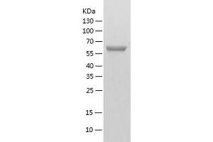 Western Blotting (WB) image for Valosin Containing Protein (VCP) (AA 1-589) protein (His tag) (ABIN7125694) (VCP Protein (AA 1-589) (His tag))
