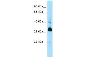 WB Suggested Anti-Mapre1 Antibody Titration: 1. (MAPRE1 Antikörper  (C-Term))