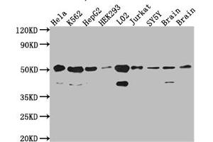 Western Blot Positive WB detected in: Hela whole cell lysate, K562 whole cell lysate, HepG2 whole cell lysate, HEK293 whole cell lysate, L02 whole cell lysate, Jurkat whole cell lysate, SH-SY5Y whole cell lysate, Mouse Brain whole cell lysate, Rat Brain cell lysate All lanes: RbAp48 antibody at 1:1000 Secondary Goat polyclonal to rabbit IgG at 1/50000 dilution Predicted band size: 48, 48, 47, 44 kDa Observed band size: 53, 40 kDa (Rekombinanter Retinoblastoma Binding Protein 4 Antikörper)