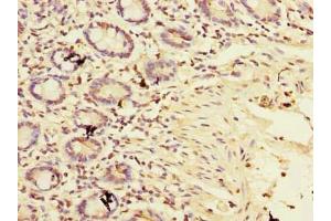 Immunohistochemistry of paraffin-embedded human small intestine tissue using ABIN7159912 at dilution of 1:100 (TIMM9 Antikörper  (AA 2-89))