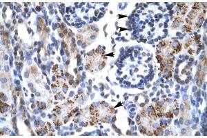 Rabbit Anti-GFI1B Antibody Catalog Number: ARP30093 Paraffin Embedded Tissue: Human Kidney Cellular Data: Epithelial cells of renal tubule and renal corpuscle Antibody Concentration: 4. (GFI1B Antikörper  (N-Term))