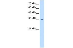 WB Suggested Anti-TRPM5 Antibody Titration:  0. (TRPM5 Antikörper  (N-Term))
