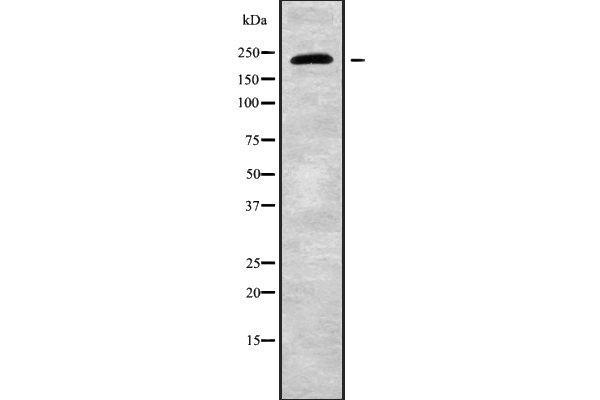 CHD2 antibody  (C-Term)