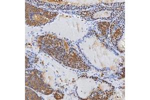 IHC analysis of Syntenin 2/SDCBP2 using anti-Syntenin 2/SDCBP2 antibody (ABIN7600017). (SDCBP2 Antikörper  (AA 14-292))