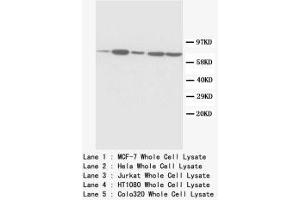 Image no. 1 for anti-Succinate Dehydrogenase Complex, Subunit A, Flavoprotein (Fp) (SDHA) (C-Term) antibody (ABIN1493069)