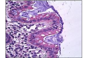 Human Colon, Epithelium: Formalin-Fixed, Paraffin-Embedded (FFPE)