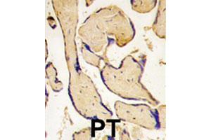 Formalin-fixed and paraffin-embedded human placenta tissue reacted with EPHA3 polyclonal antibody , which was peroxidase-conjugated to the secondary antibody, followed by DAB staining. (EPH Receptor A3 Antikörper  (C-Term))