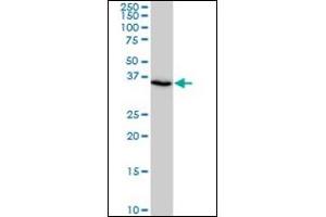 Western Blotting (WB) image for anti-SMAD, Mothers Against DPP Homolog 3 (SMAD3) antibody (ABIN781907)