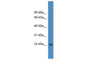WB Suggested Anti-OTUB2 Antibody Titration: 0. (OTUB2 Antikörper  (N-Term))