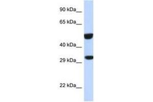 Image no. 1 for anti-V-Ets Erythroblastosis Virus E26 Oncogene Homolog 2 (ETS2) (AA 311-360) antibody (ABIN6747755) (ETS2 Antikörper  (AA 311-360))