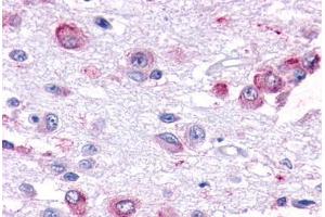Human Brain, Hypothalamus (formalin-fixed, paraffin-embedded) stained with GPR101 antibody ABIN291950 at 7. (GPR101 Antikörper  (Cytoplasmic Domain))