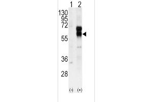 Western blot analysis of ACVRL1 using rabbit polyclonal ACVRL1 Antibody using 293 cell lysates (2 ug/lane) either nontransfected (Lane 1) or transiently transfected with the ACVRL1 gene (Lane 2). (ACVRL1 Antikörper  (N-Term))