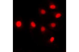 Immunofluorescent analysis of SIN3B staining in HCT116 cells.