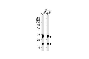 Western blot analysis of lysates from Daudi, Raji cell line (from left to right), using CD74 Antibody (ABIN1944838 and ABIN2838498). (CD74 Antikörper  (AA 1-232))