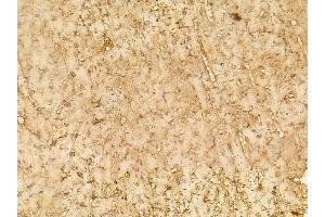 Alanine Transaminase Mouse Monoclonal Antibody at 1/100 staining rat heart tissue by IHC-P. (ALT Antikörper)
