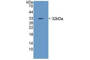 Detection of Recombinant ZRF1, Mouse using Polyclonal Antibody to Zuotin Related Factor 1 (ZRF1) (DNAJC2 Antikörper  (AA 368-621))