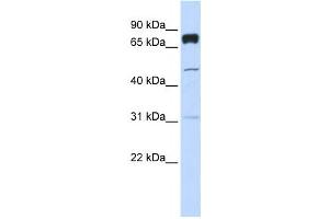 Western Blotting (WB) image for anti-Pleckstrin Homology Domain Containing, Family A (phosphoinositide Binding Specific) Member 4 (PLEKHA4) antibody (ABIN2458667) (PLEKHA4 Antikörper)