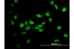 Immunofluorescence of monoclonal antibody to MDS028 on HeLa cell. (ITFG2 Antikörper  (AA 1-447))