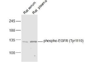 Lane 1: Rat serum lysates Lane 2: Rat plasma lysates probed with phospho-EGFR (Tyr1110) Polyclonal Antibody, Unconjugated  at 1:1000 dilution and 4˚C overnight incubation. (EGFR Antikörper  (pTyr1110))