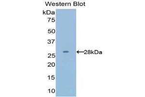 Western Blotting (WB) image for anti-Latexin (LXN) (AA 1-222) antibody (ABIN1078269) (Latexin Antikörper  (AA 1-222))