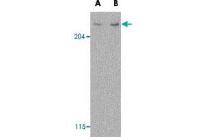 Western blot analysis of MTOR in L1210 cell lysate with MTOR polyclonal antibody  at (A) 1 and (B) 2 ug/mL .