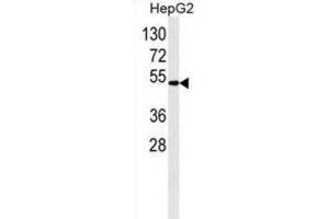 Western Blotting (WB) image for anti-Aldehyde Dehydrogenase 2 Family (Mitochondrial) (ALDH2) antibody (ABIN2995313) (ALDH2 Antikörper)