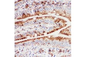 Anti-Hsp105 antibody, IHC(F) IHC(F): Rat Intestine Tissue (HSPH1 Antikörper  (C-Term))