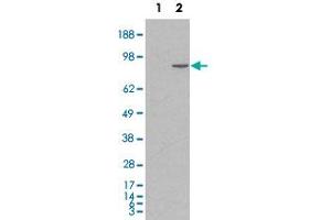 HEK293 overexpressing human CTNNA1 and probed with CTNNA1 polyclonal antibody  (mock transfection in first lane), tested by Origene.
