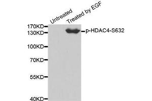 Western blot analysis of extracts from 293 cells using Phospho-HDAC4-S632 antibody. (HDAC4 Antikörper  (pSer632))