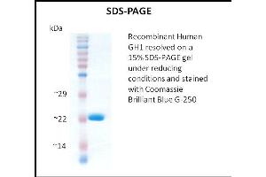 SDS-PAGE (SDS) image for Growth Hormone 1 (GH1) (Active) protein (ABIN5509312)