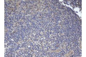 Image no. 2 for anti-B-Cell CLL/lymphoma 10 (BCL10) antibody (ABIN1496847) (BCL10 Antikörper)
