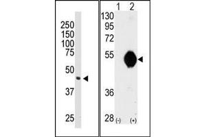 Image no. 1 for anti-DOK2 (DOK2) (C-Term) antibody (ABIN359960) (DOK2 Antikörper  (C-Term))