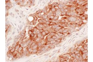 anti-Reticulon 3 (RTN3) (AA 750-800) antibody