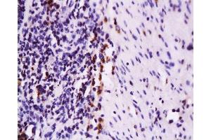 Formalin-fixed and paraffin embedded rat colon tissue labeled with Anti-Fas Polyclonal Antibody, Unconjugated  at 1:200 followed by conjugation to the secondary antibody and DAB staining (FAS Antikörper  (AA 35-110))