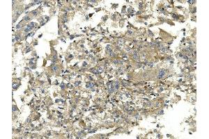 IHC analysis of EEF2 using anti-EEF2 antibody (ABIN7603141). (EEF2 Antikörper  (N-Term))