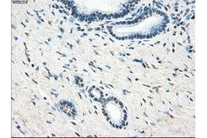 Immunohistochemical staining of paraffin-embedded Ovary tissue using anti-LTA4H mouse monoclonal antibody. (LTA4H Antikörper)