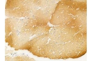 ABIN6265804 and ABIN6266666 at 1/100 staining human normal gastric tissue by IHC-P. (gamma Tubulin Antikörper  (N-Term))