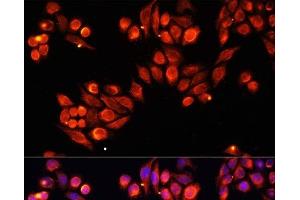 Immunofluorescence analysis of HeLa cells using Heparanase 1 Polyclonal Antibody at dilution of 1:100. (HPSE Antikörper)
