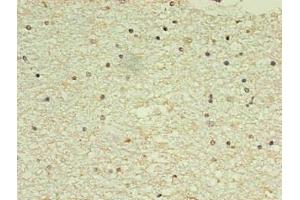Immunohistochemistry (IHC) image for anti-Natriuretic Peptides B (NPPB) antibody (ABIN7161735)
